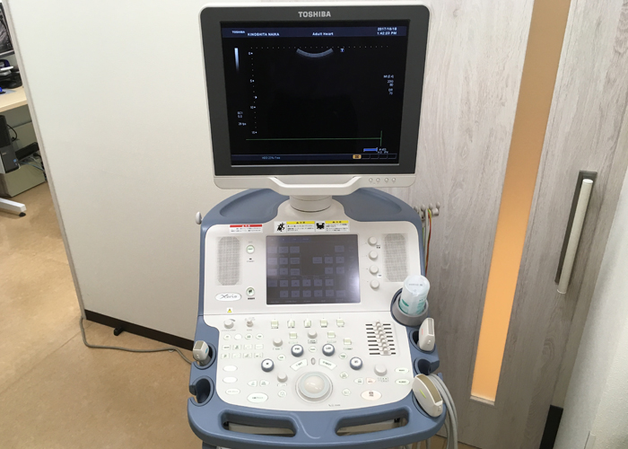 超音波診断装置画像